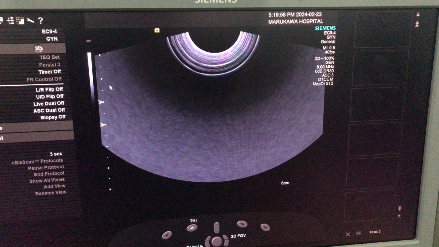 …Siemens EC9-4 Tvs probe