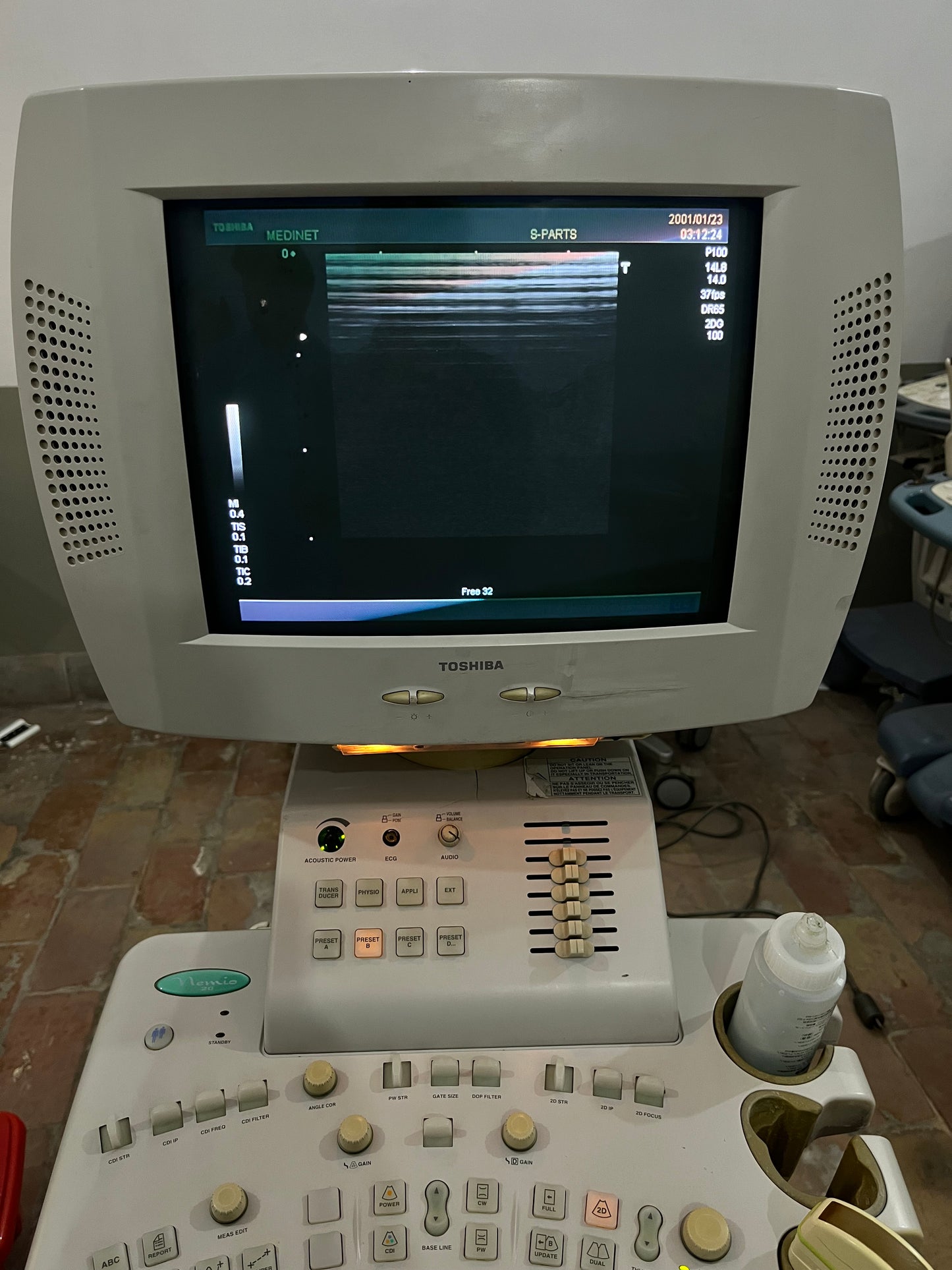 Toshiba Nemio 20 with convex linear probe