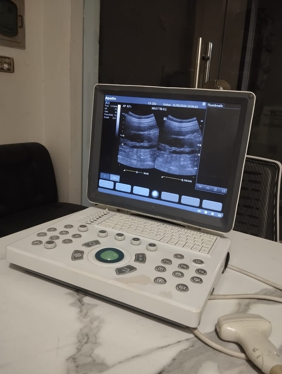 B..Apollo 11 china used portable ultrasound machine with convex probe,with 2 hours battery back up.