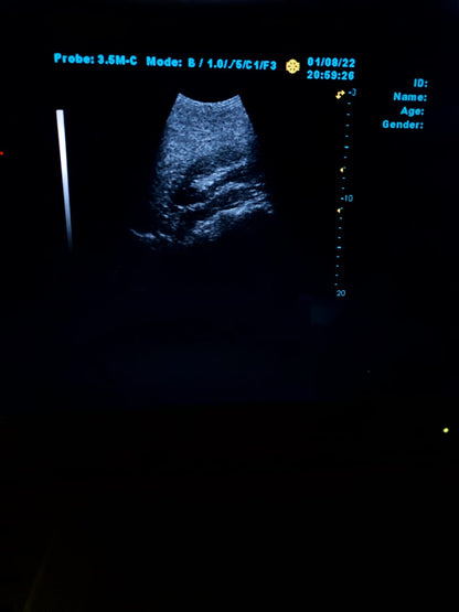 B..Linkton gray scale ultrasound machine, china used with convex probe