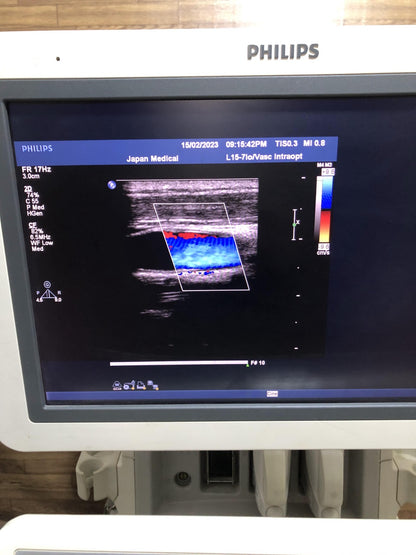 Philips L15-7io linear array transducer probe - Japan Medical Company LTD