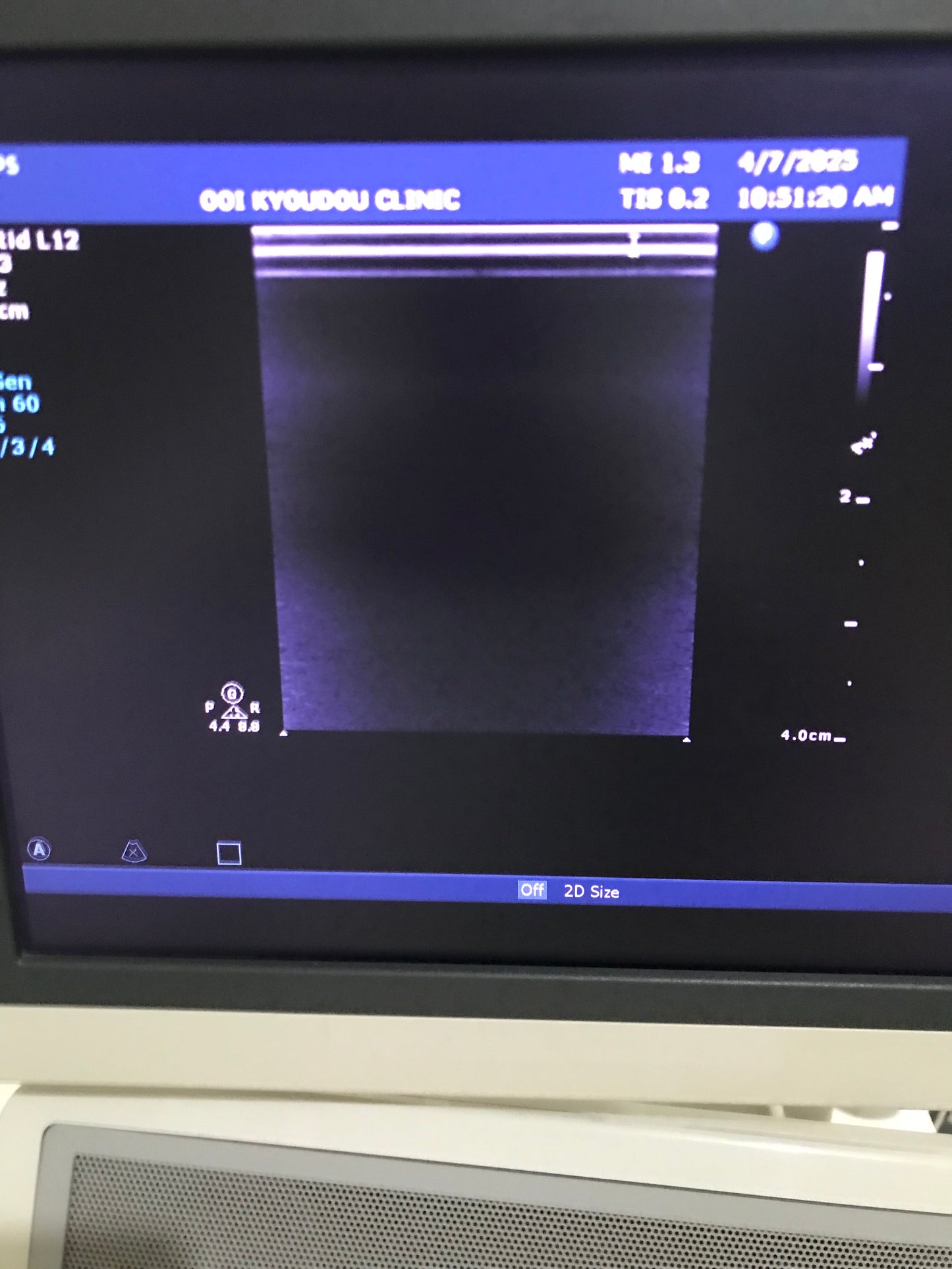 Phillips:L12-3: linear probe