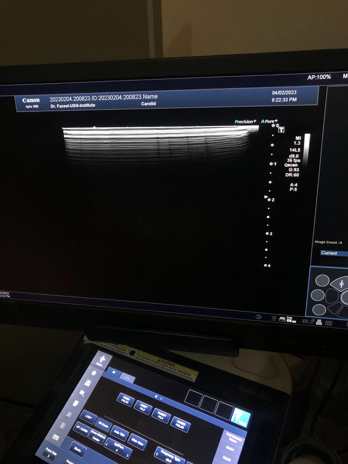 Toshiba linear probe PLT-1005BT - Japan Medical Company LTD