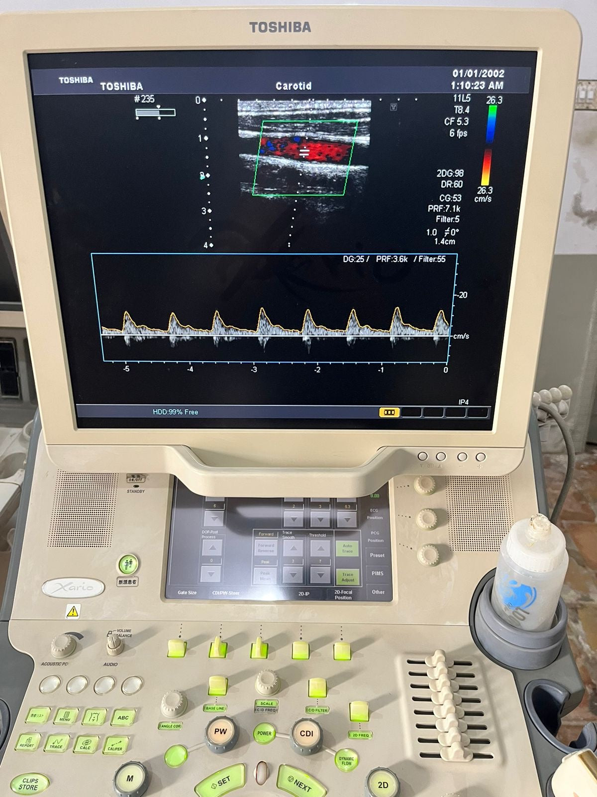 Toshiba Xario prime with convex linear probe