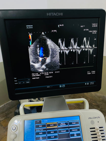 Hitachi Aloka ARIETTA 60 with convex linear cardiac probe, convex probe has air shade. Also can sell it's probes and parts separately