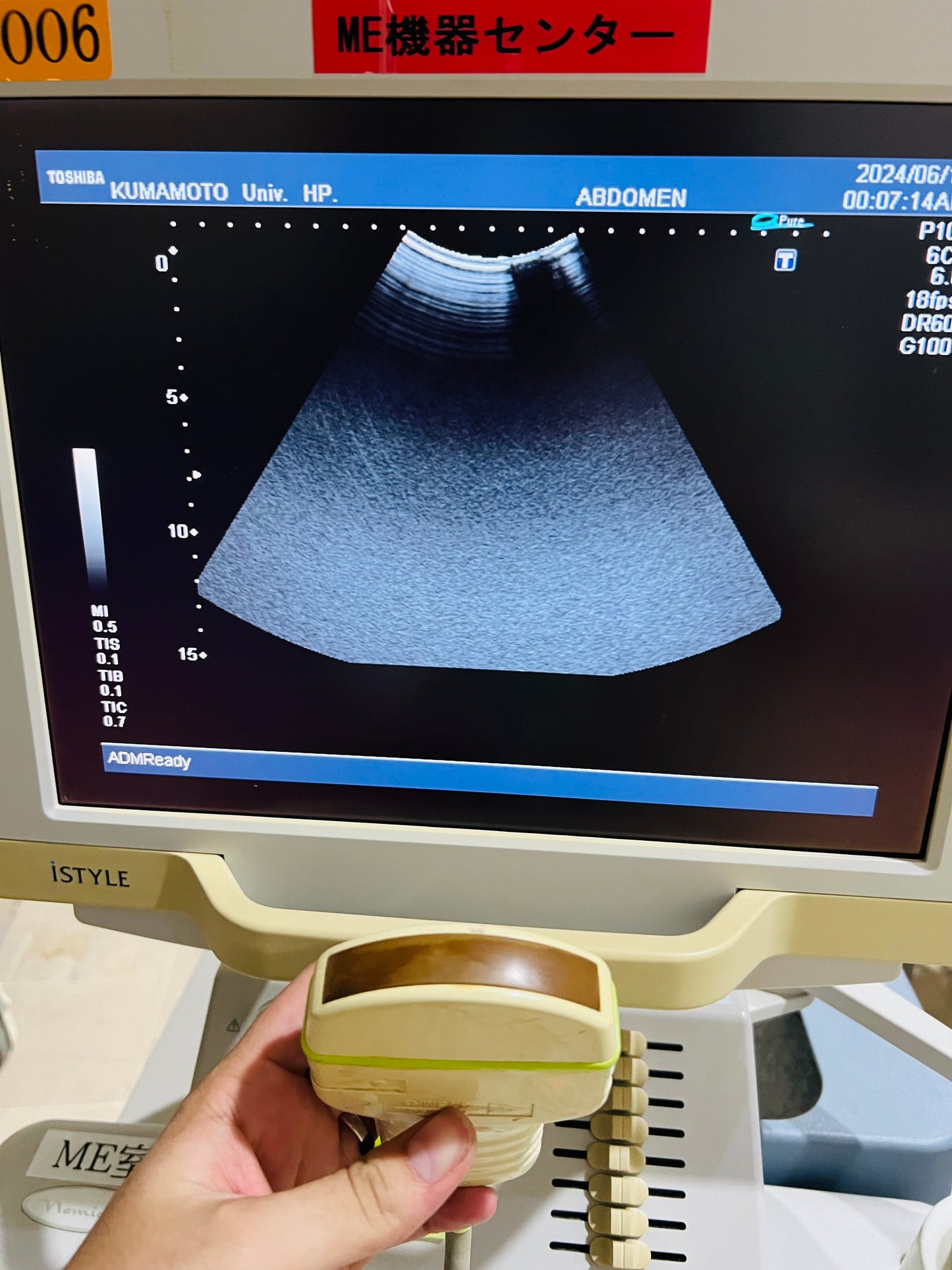 …Toshiba PVM-375AT convex probe