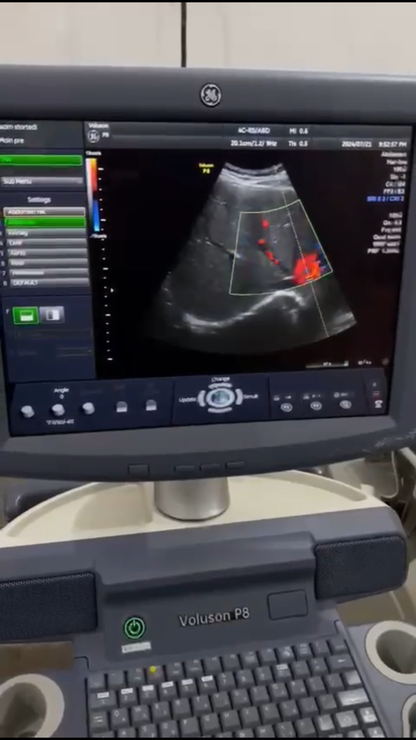 GE Voluson P8 with convex/linear probe mfg 2013,
