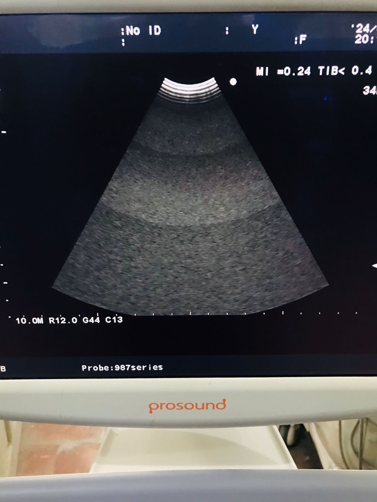 Z..Aloka UST-987-7.5 microo convex Probe