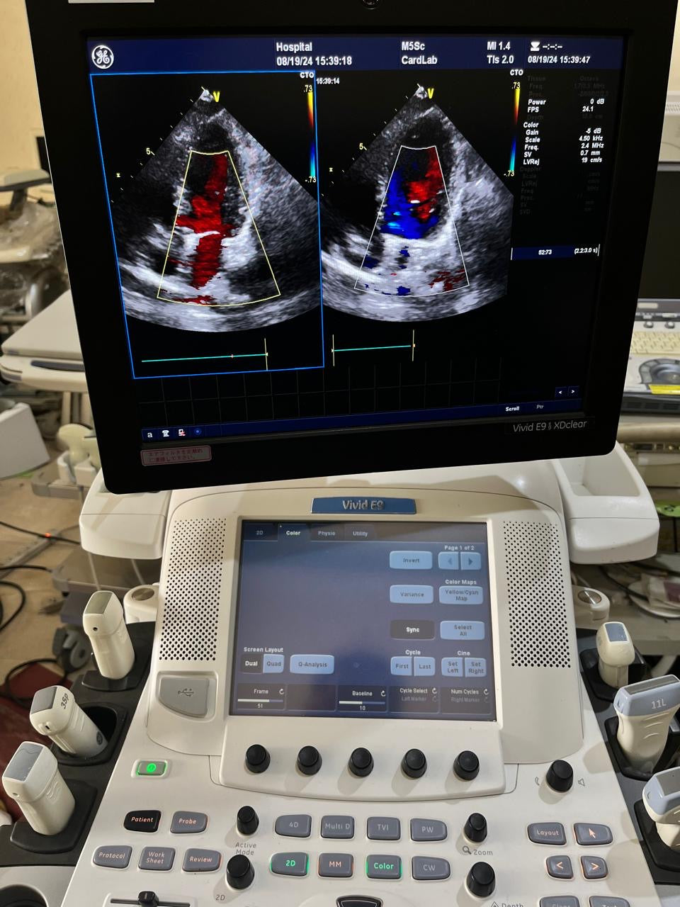 ..Ge M5Sc-D Cardiac Probe