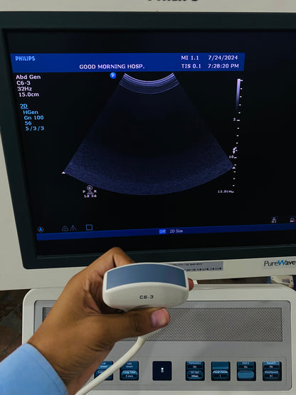 Philips HD15 with convex linear probe mfg 2012, Also can sell its parts, probes