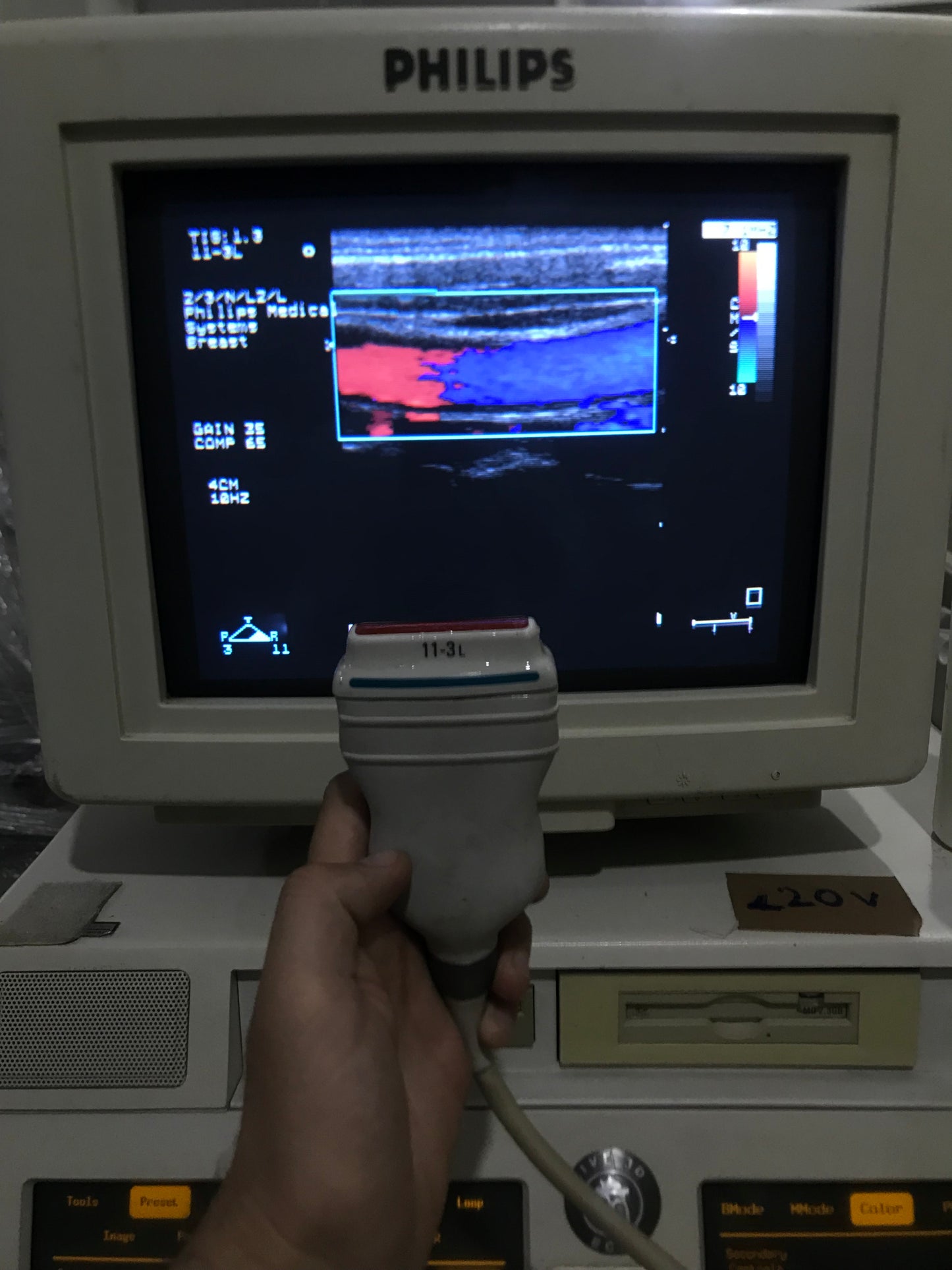 P...Philips 11-3L Linear Probe checked dxb