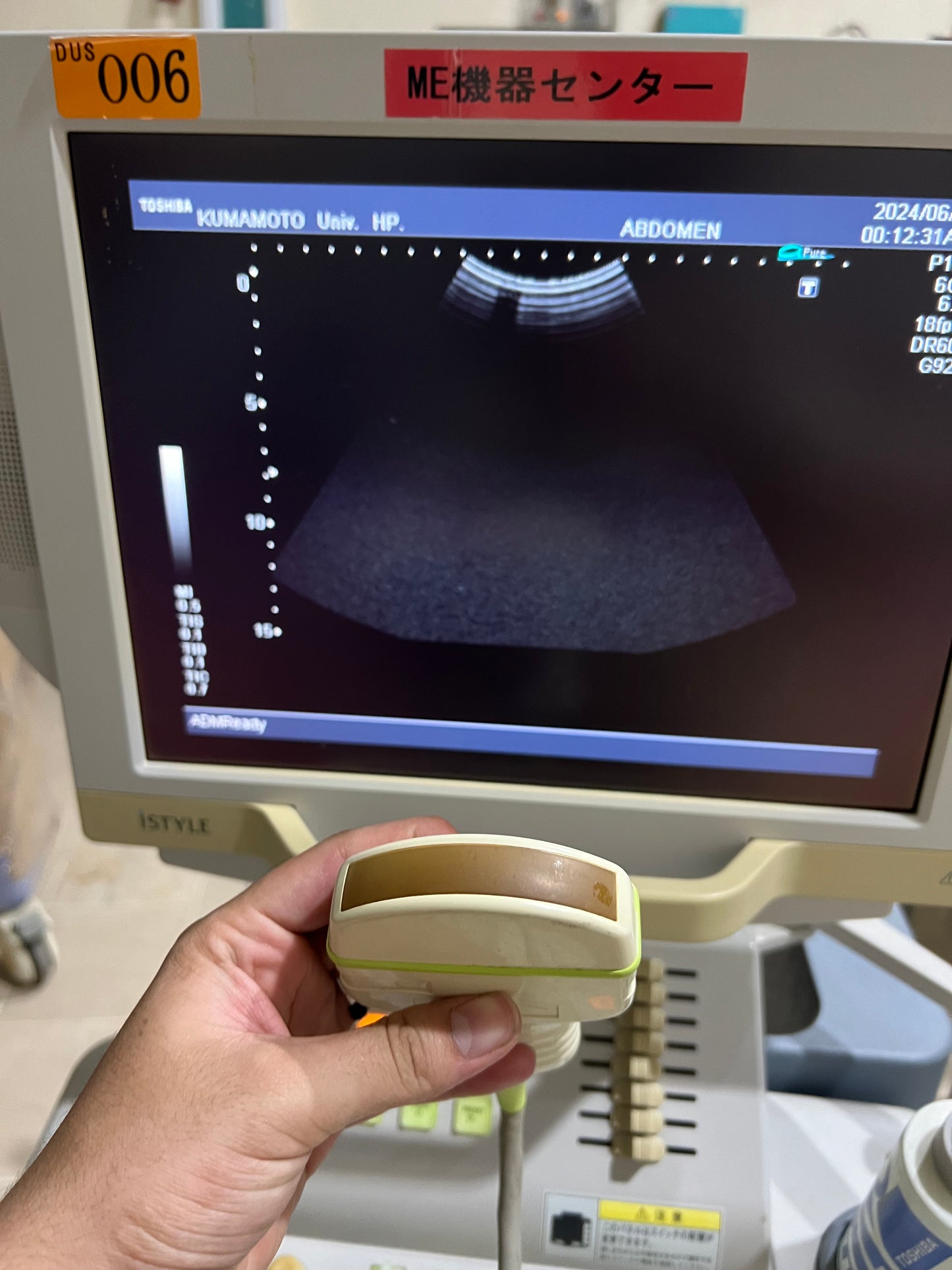 ..Toshiba PVM-375AT convex probe