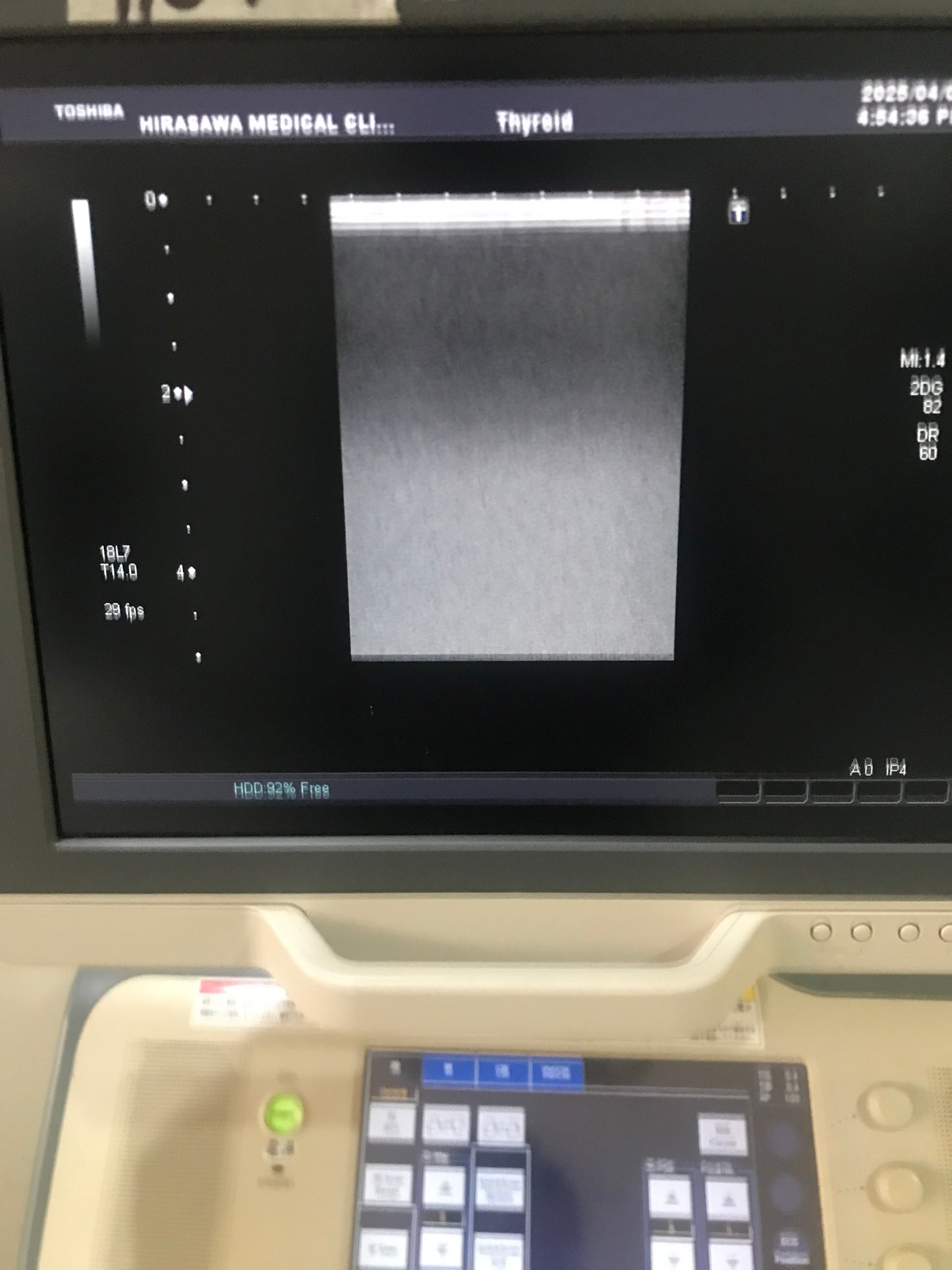 PLT-1204BT linear probe