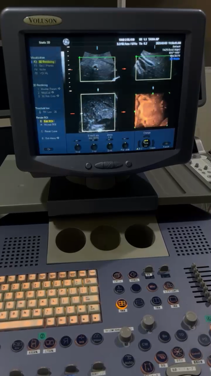 GE Voluson 730 pro v with convex probe