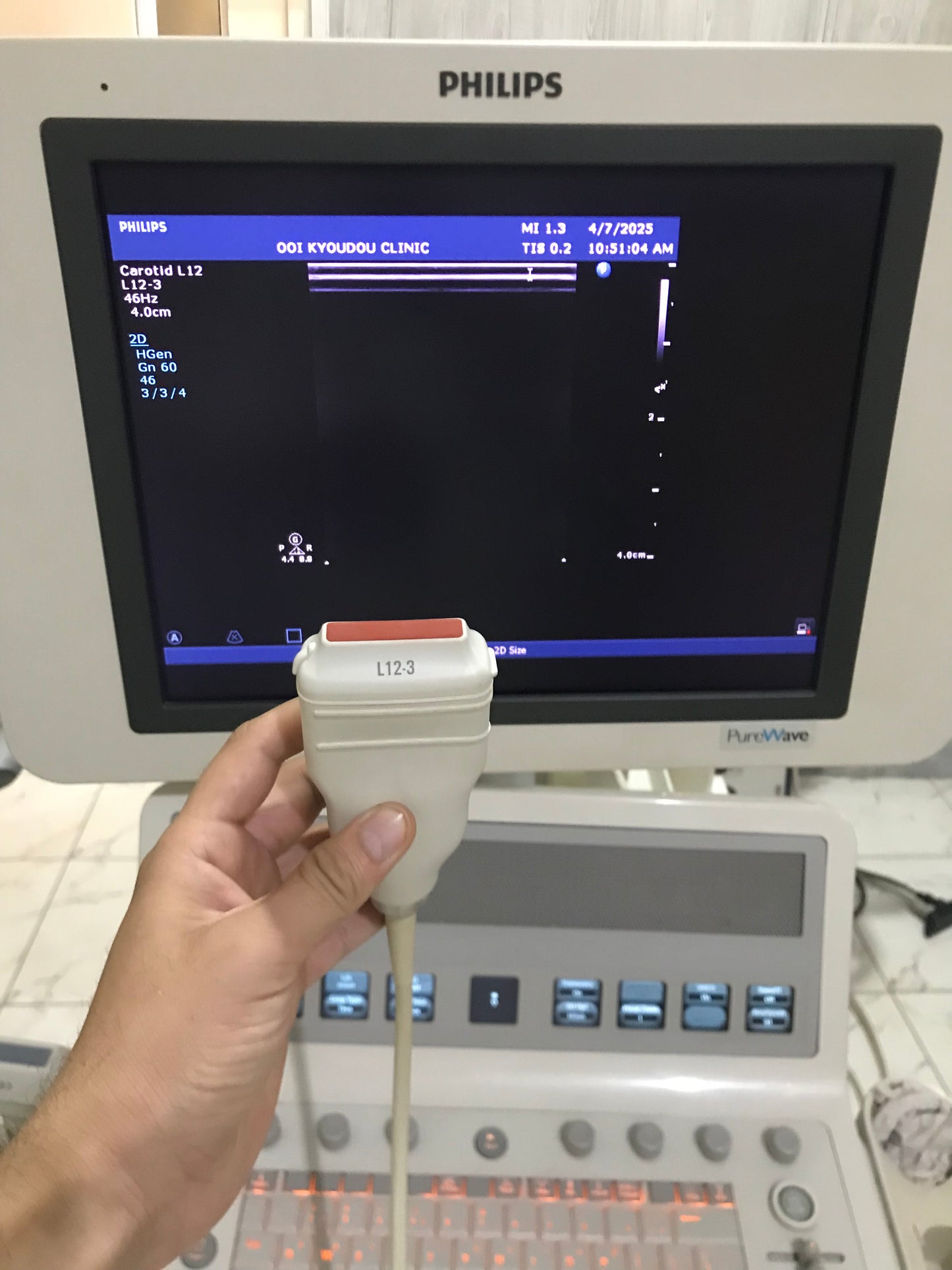 Phillips:L12-3: linear probe