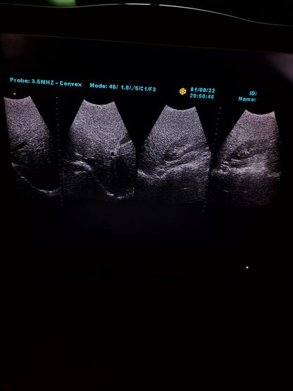 B..Linkton gray scale ultrasound machine, china used with convex probe