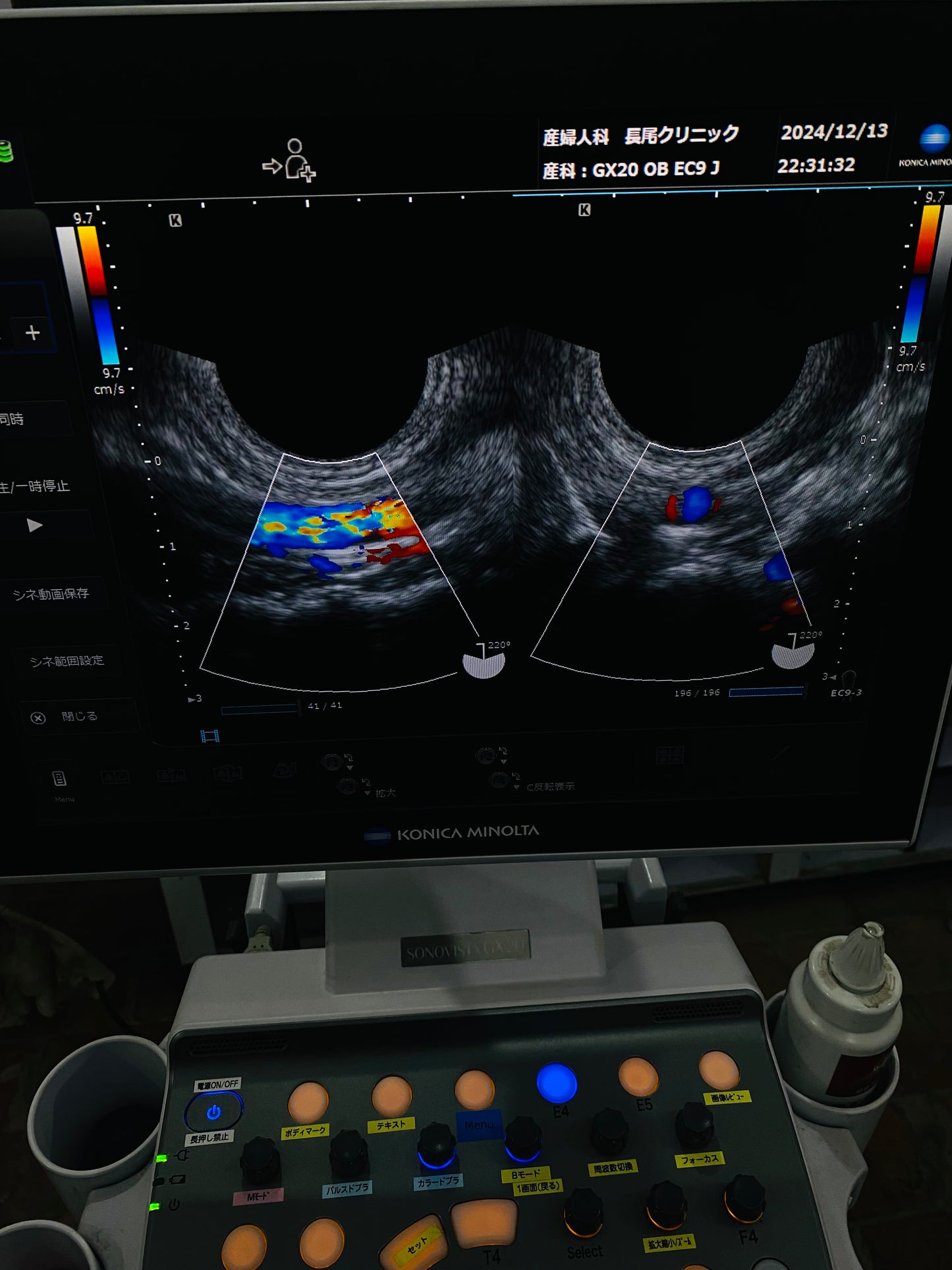 Siemens EC9-3 TVs Probe