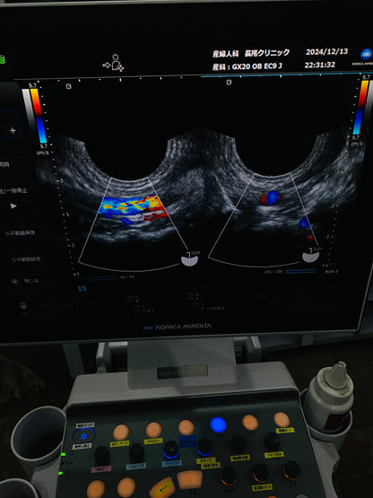 Siemens EC9-3 TVs Probe