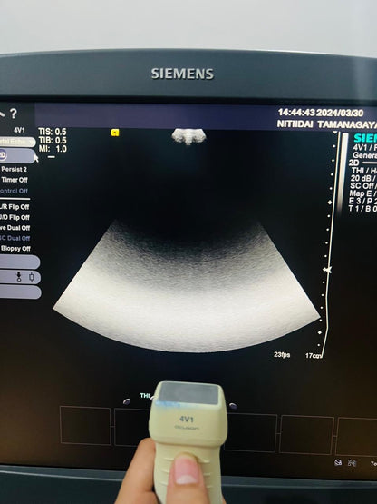 ..Siemens 4V1 cardiac probe