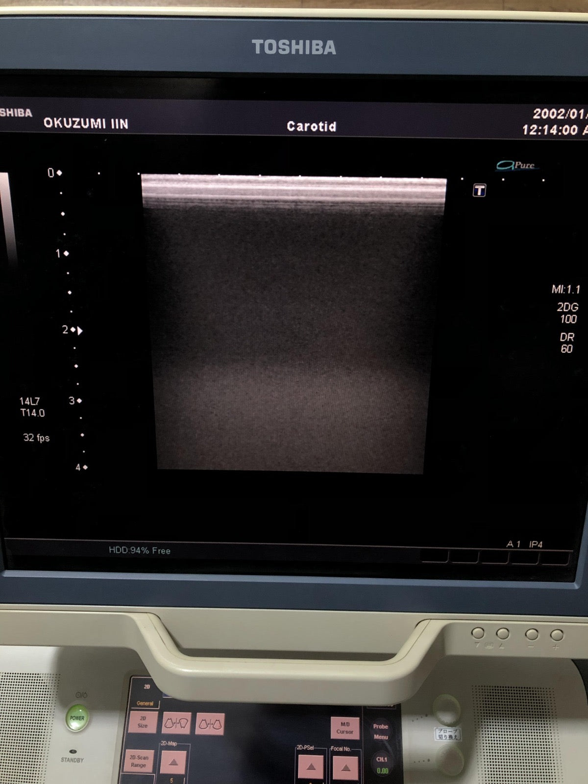 Toshiba PLT-1204AT linear probe - Japan Medical Company LTD