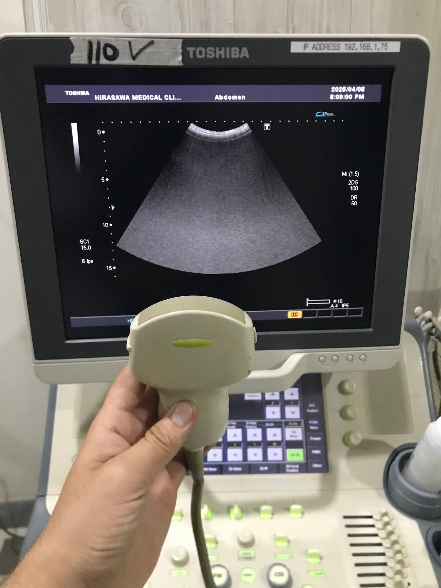 ...Toshiba PVT-375BT Convex Probe