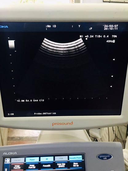 Z..Aloka UST-987-7.5 microo convex Probe