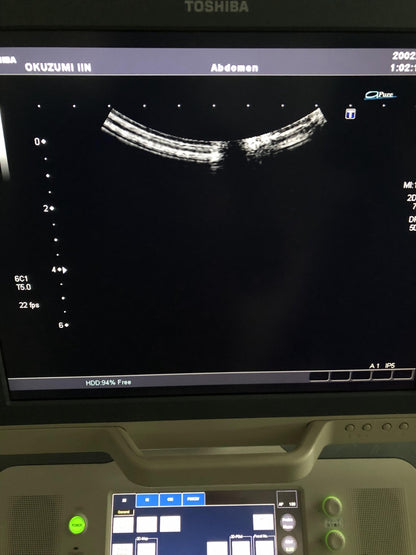 Toshiba PVT-375BT canvex probe - Japan Medical Company LTD