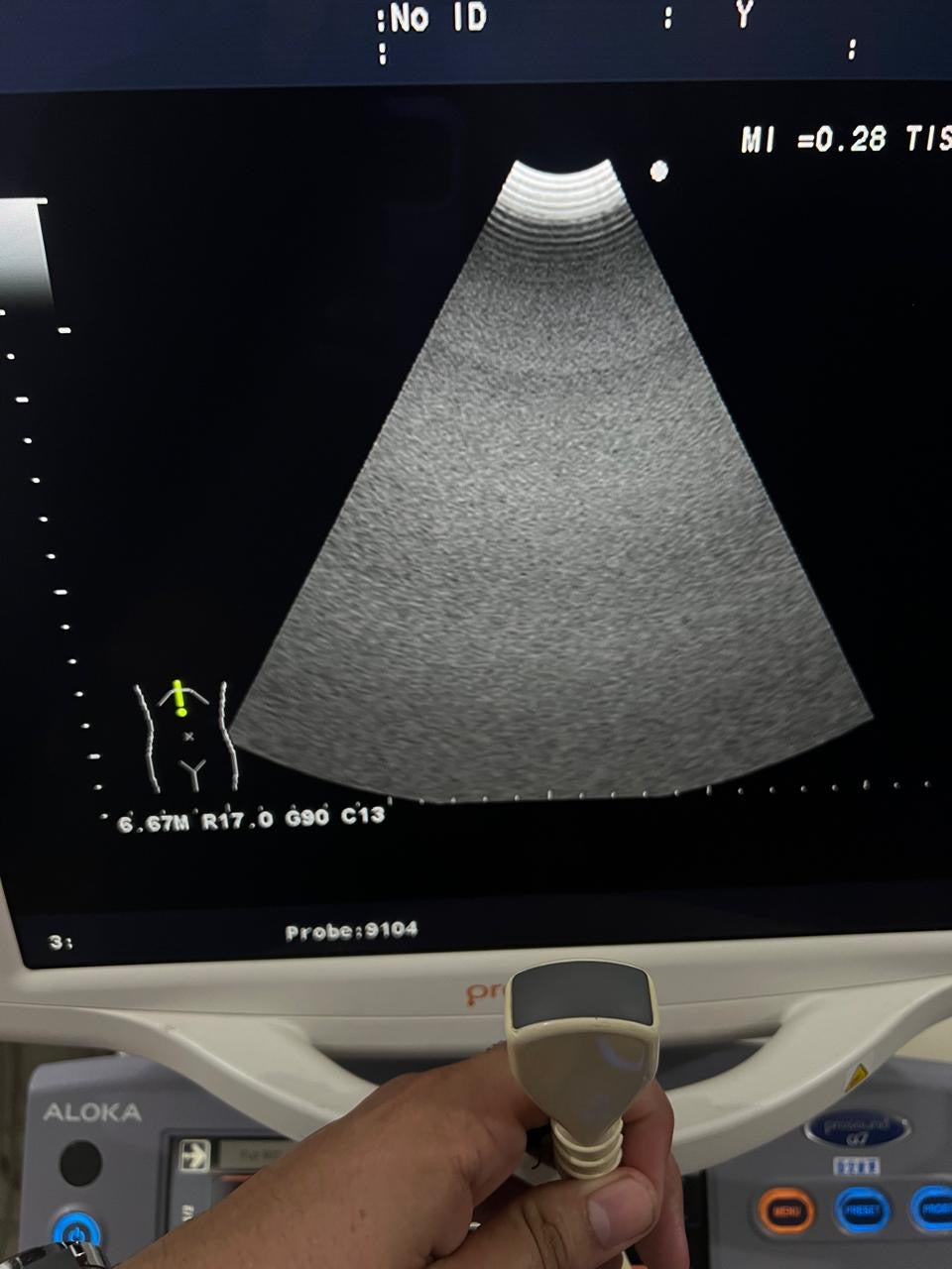 ..Aloka UST-9104-5 Microconvex probe