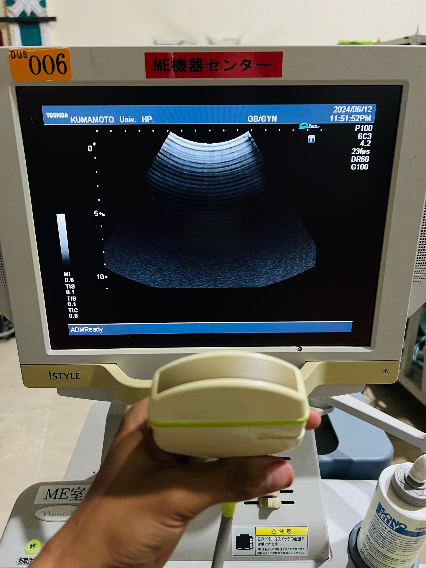 ..Toshiba PVM-375AT convex probe