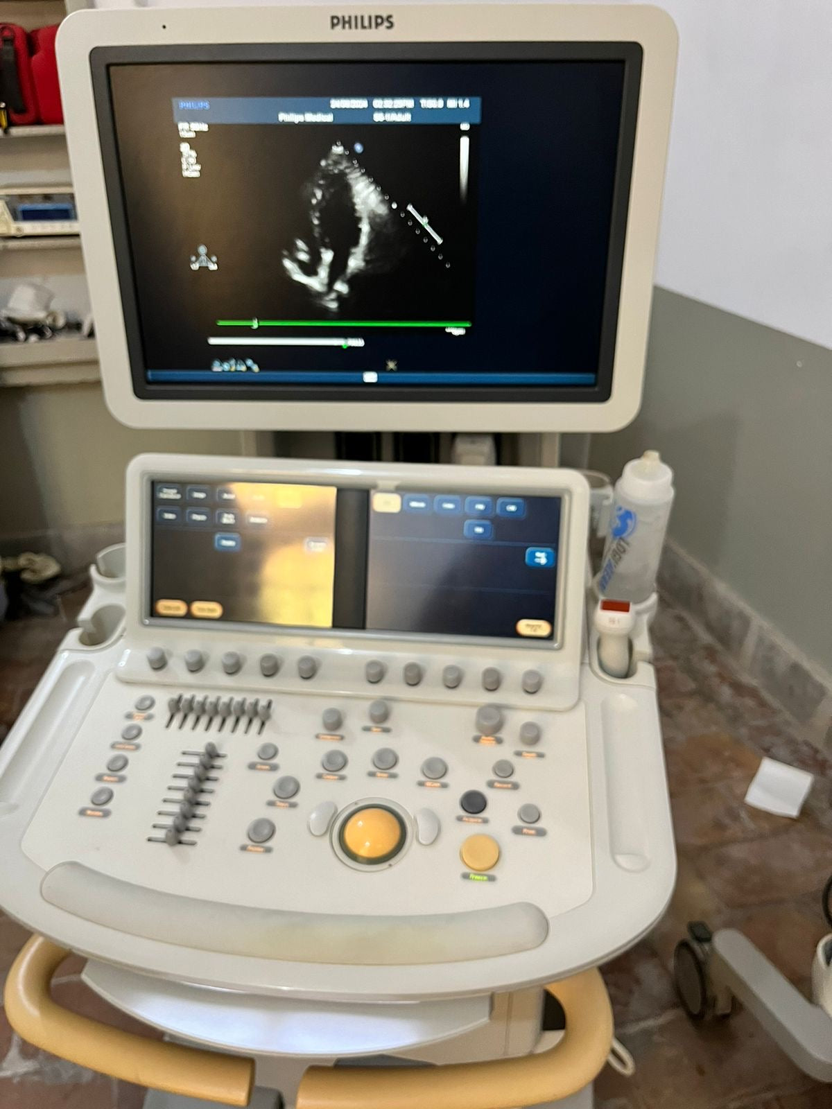 Philips ie33 with adult cardiac probe