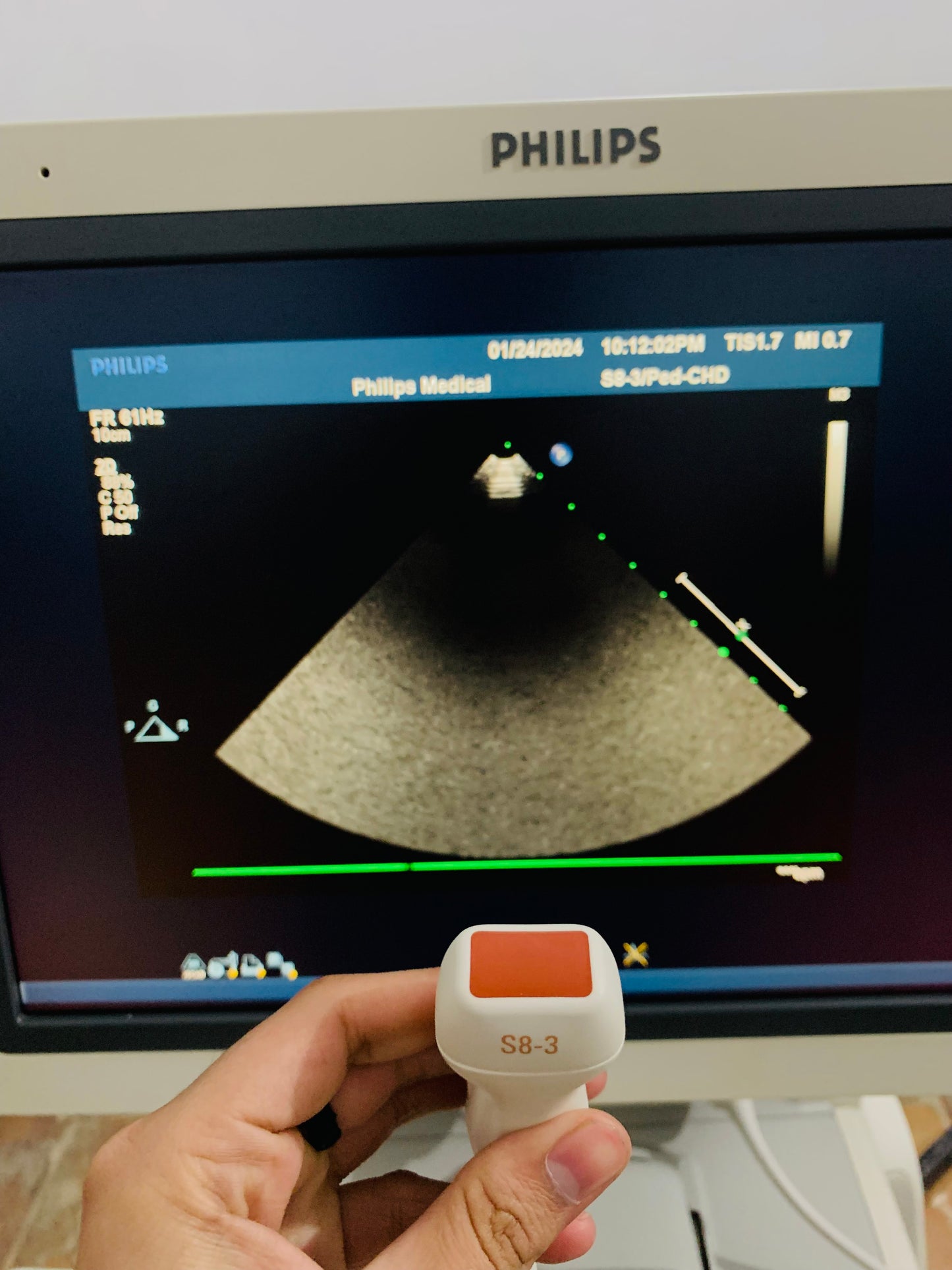 Philips IE 33 Ultrasound Machine