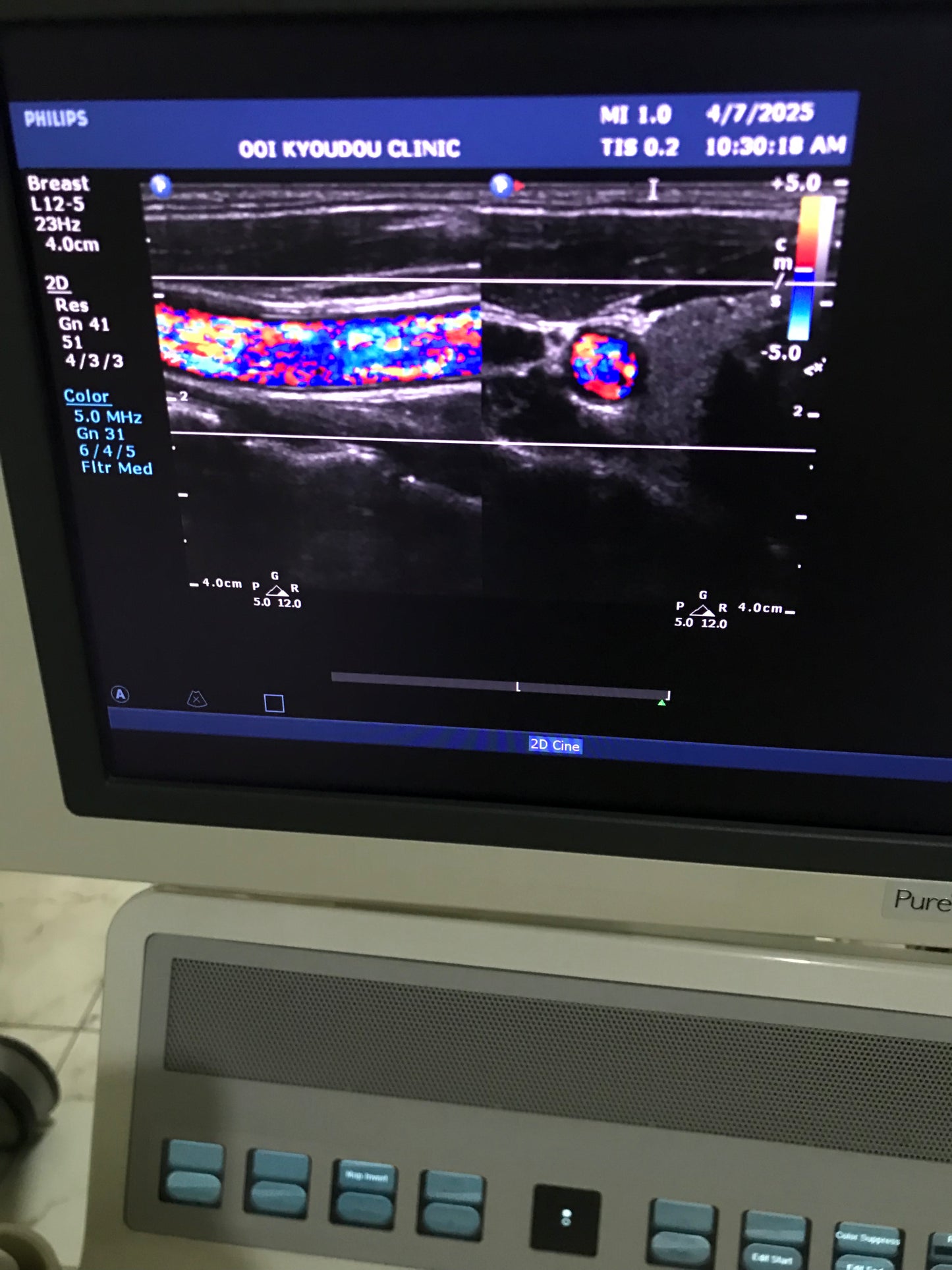 ..Philips L12-5 Linear Probe UC