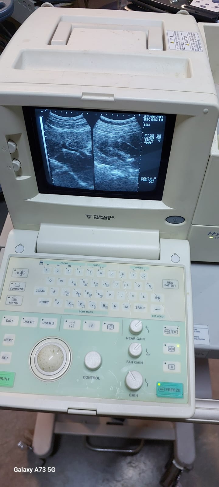 Fukuda Denshi UF-4000 Black and white ultrasound with convex probe