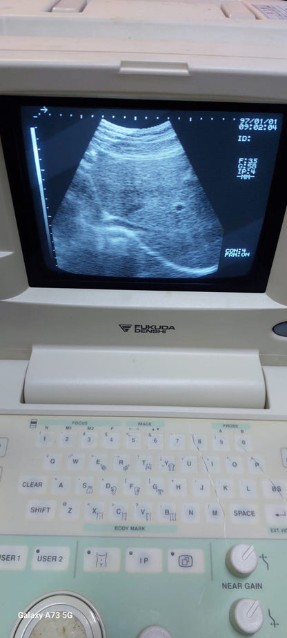 Fukuda Denshi UF-4000 Black and white ultrasound with convex probe