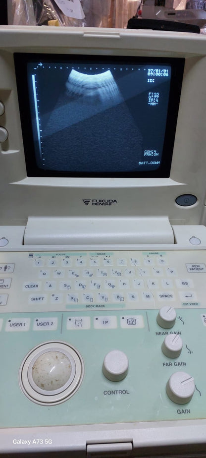 Fukuda Denshi UF-4000 Black and white ultrasound with convex probe