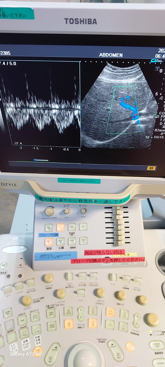 Toshiba Nemio XG with convex microvonvex and cardiac probes