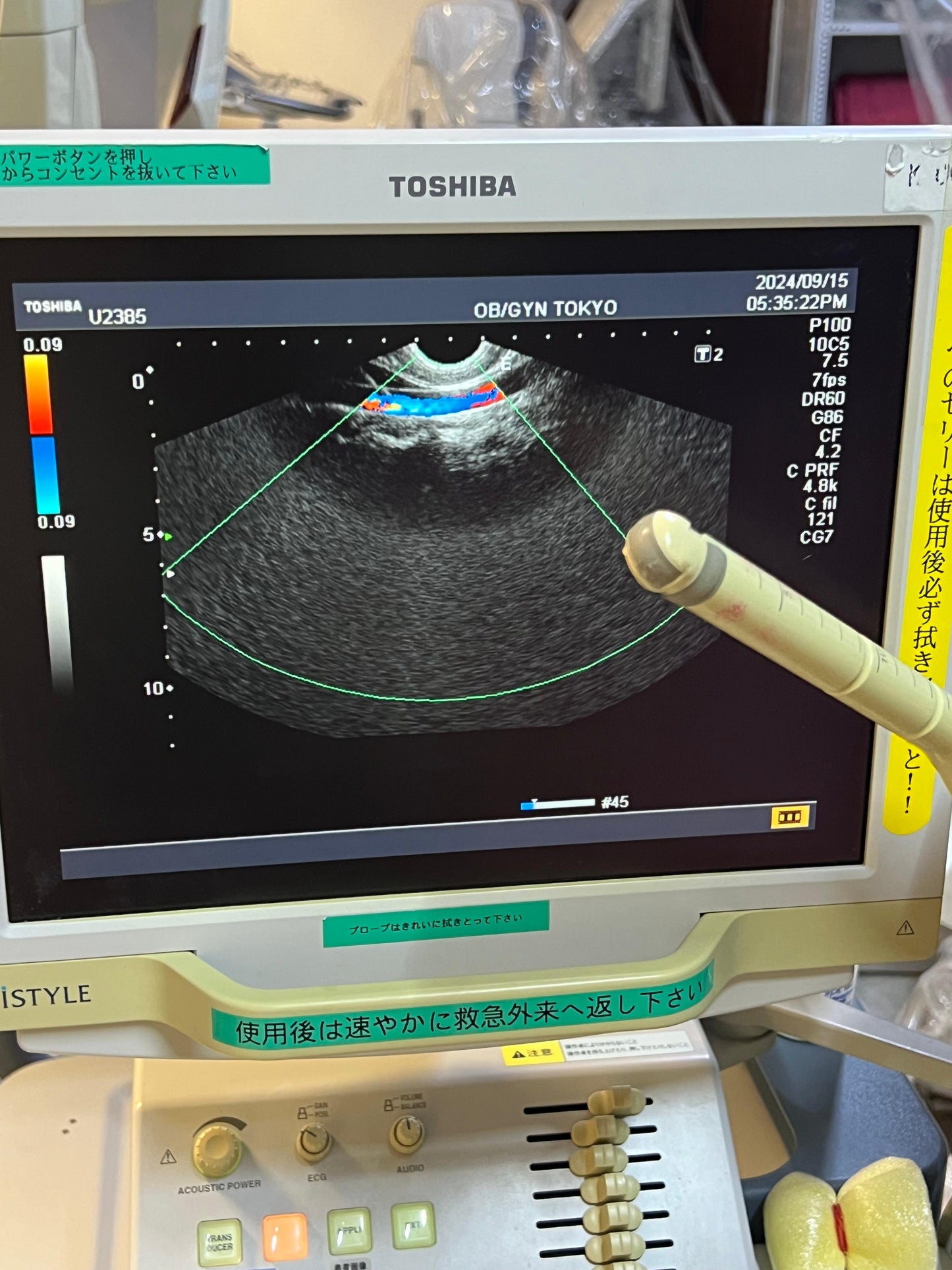 ..Toshiba PVM-740RT intra cavity transducer