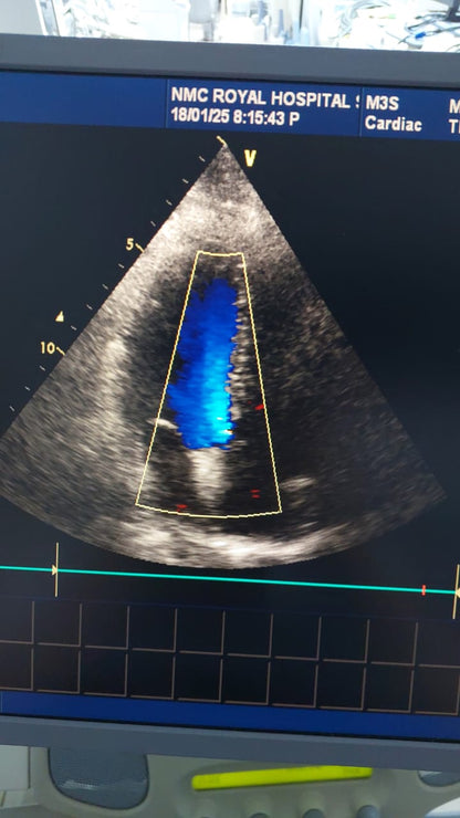 GE M3S cardiac probe (AV)