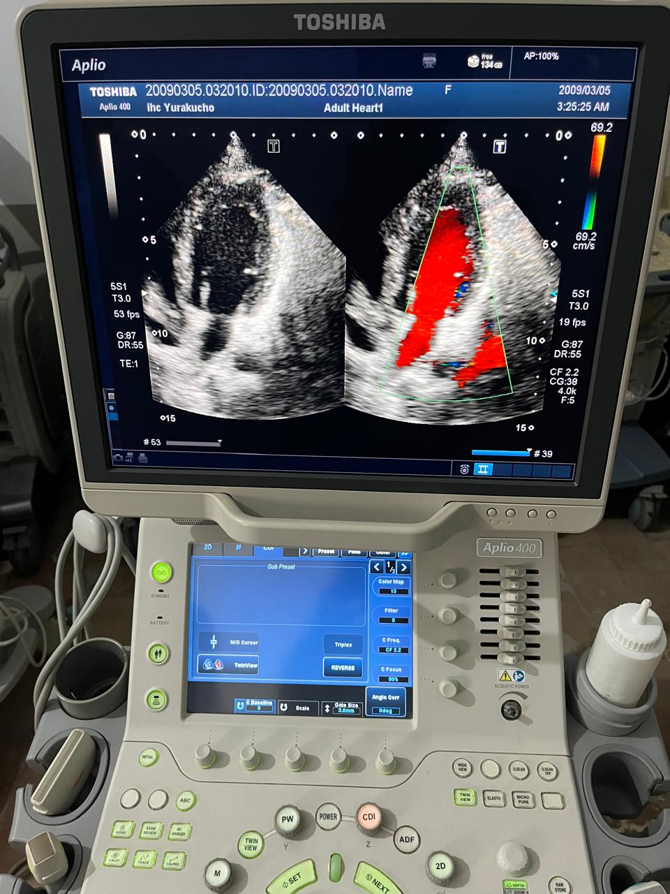 ..Toshiba PST-25BT cardiac probe