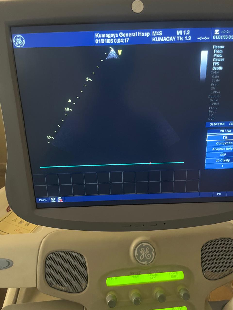 Z..Ge M4S Cardiac Probe