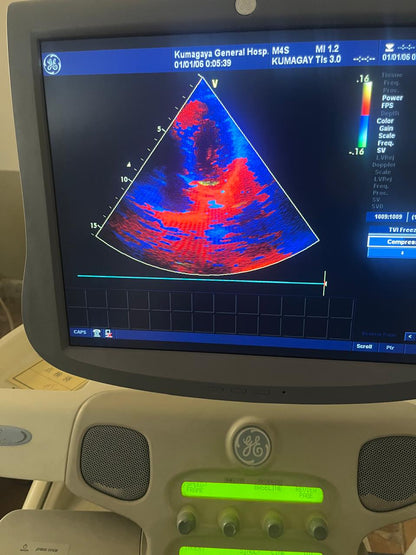 Z..Ge M4S Cardiac Probe