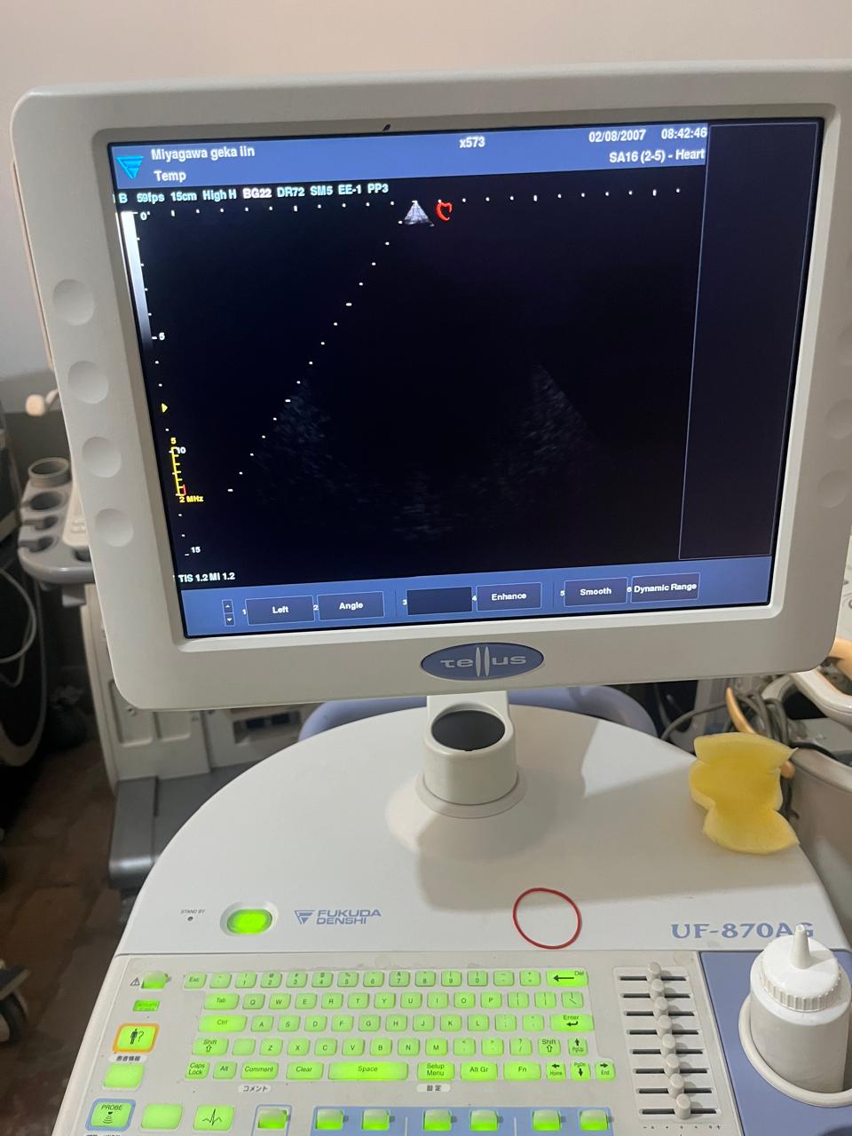 Z..Fukuda Denshi FUT-SA162-5A cardiac probe