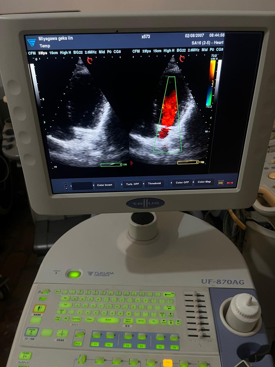 Z..Fukuda Denshi FUT-SA162-5A cardiac probe