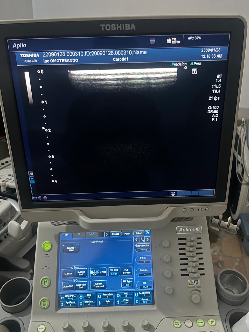 ..Toshiba PLT-704AT linear probe