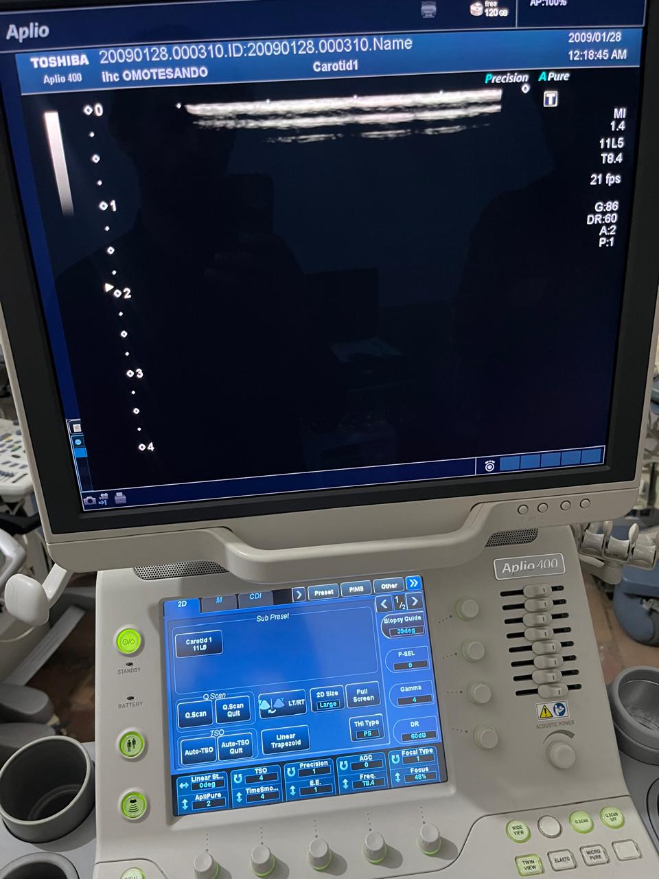 ..Toshiba PLT-704AT linear probe