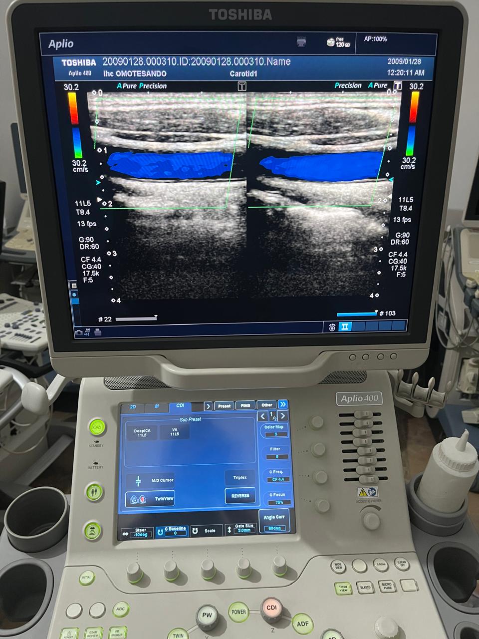 ..Toshiba PLT-704AT linear probe