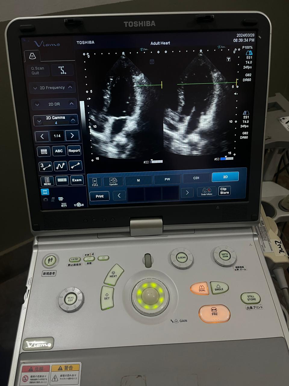 Z..Toshiba PST-25ST cardiac probe