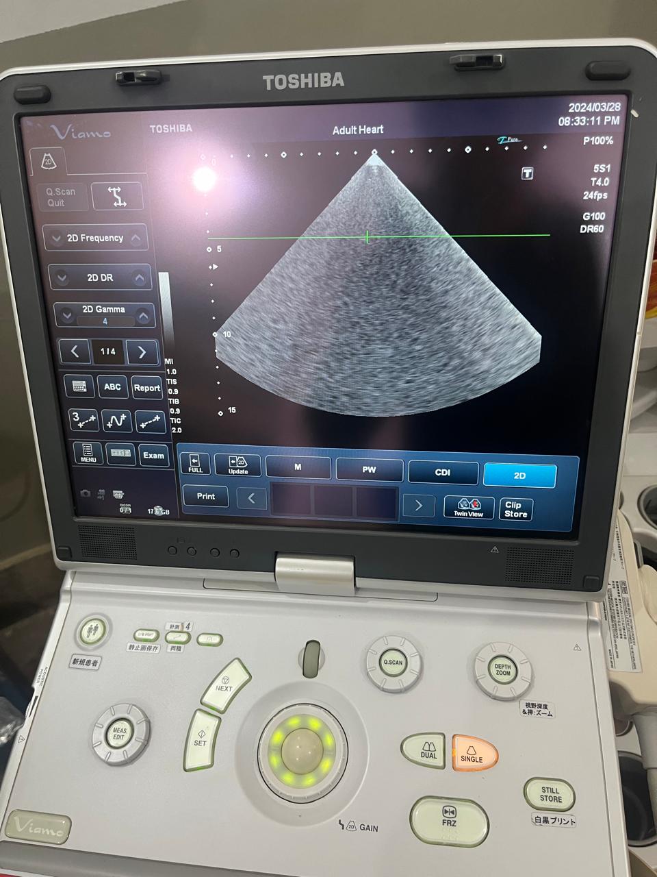 Z..Toshiba PST-25ST cardiac probe