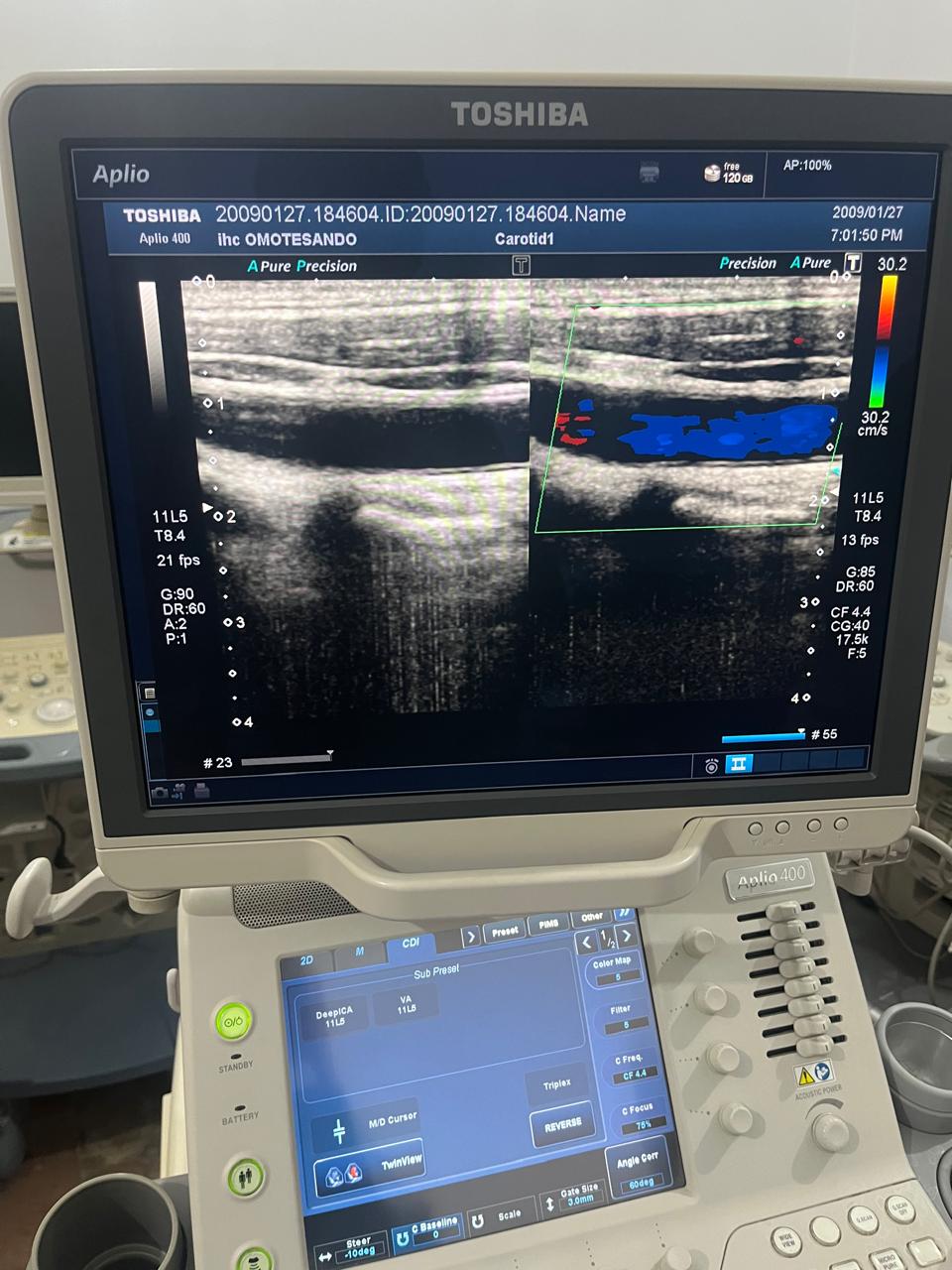 Z..Toshiba PLT-704AT linear Probe