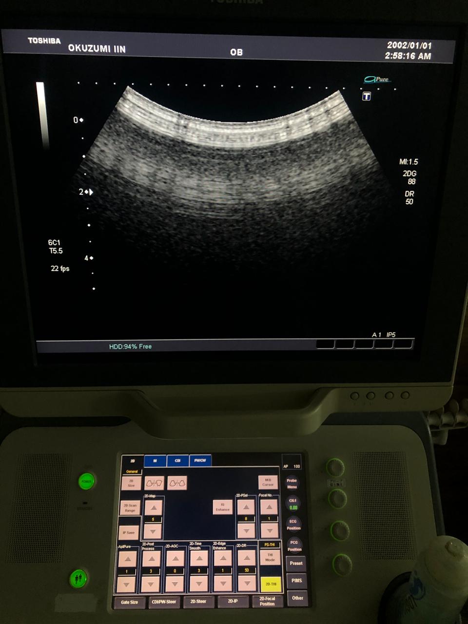 ..Toshiba PVT-375BT convex probe